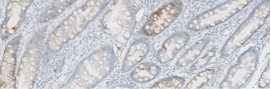 Stain Sample Score 1+