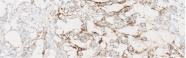 Stain Sample Score 2+