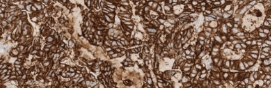 Stain Sample Score 3+